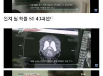 7살 암투병한 하림이 근황