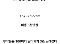 키 10cm 늘린 일본의사