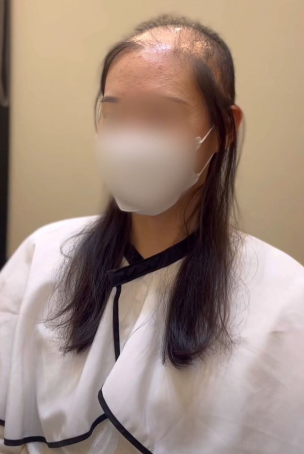 감쪽같은 여자 탈모 가발