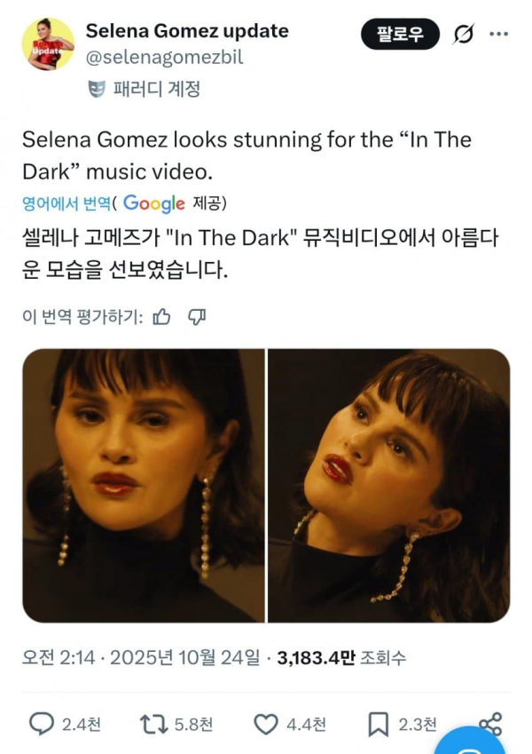 셀레나 고메즈 충격 근황