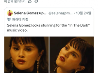 셀레나 고메즈 충격 근황